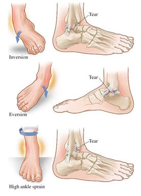 Foot-and-Ankle